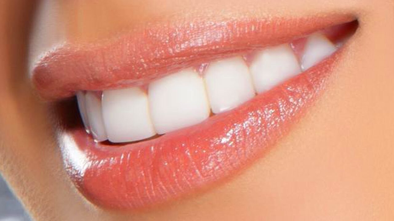 الابتسامة الكاملة – فينير وهوليود سمايل أيهما الأنسب لك؟